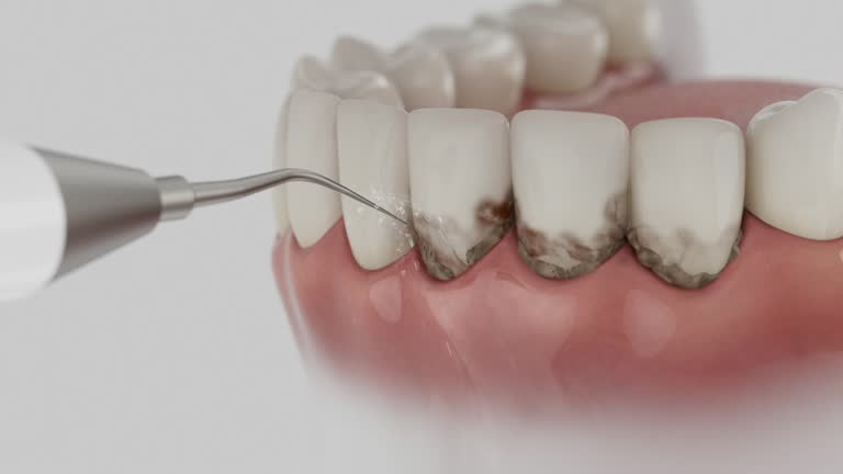 Trusted Emergency Dentist service in Long Beach, MS - Dentist Open Now